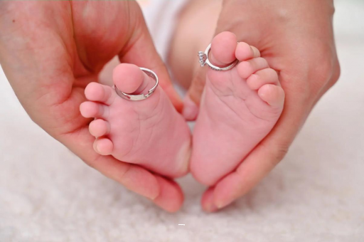 娄底孕妇怎样预防妊娠纹